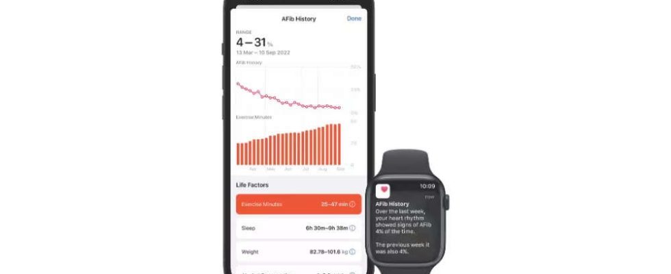 Afib Die AFib Verlaufsfunktion der Apple Watch ist jetzt in Indien