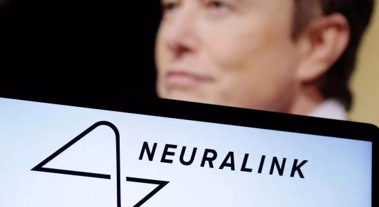 Elon Musks Neuralink rekrutiert jetzt Menschen um seine Gehirnchips auszuprobieren