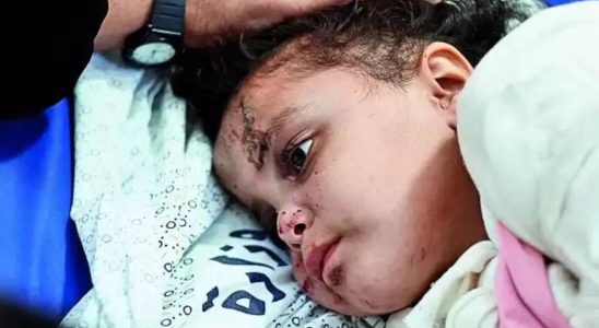 Schwierige Entscheidung Gaza Mediziner stehen vor der schwierigen Entscheidung wer lebt