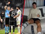 Geblesseerde Marseille-speler Correa boos op Berghuis: 'Je zei dat het niets was'