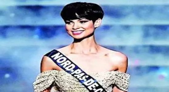 Kurzes Haar Die Gewinnerin der Miss France bezeichnet ihre kurzen
