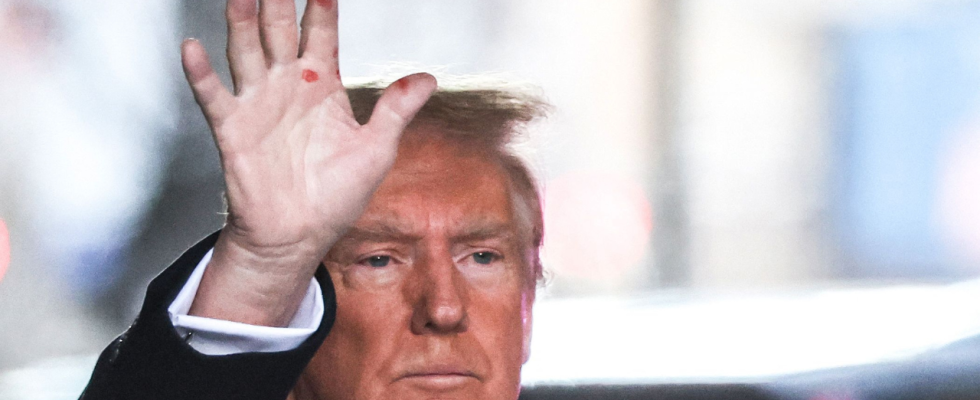 Was sich hinter den mysterioesen roten Flecken auf Trumps Haenden
