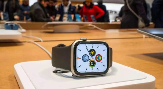 Apple Watch Modelle koennen Schweiss verwenden um Ihren Gesundheitszustand zu ueberpruefen