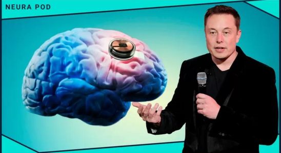 Elon Musks Unternehmen will die Menschheit mit Implantaten verbessern