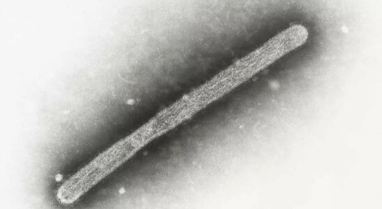 USA meldet zweiten menschlichen Vogelgrippefall im Zusammenhang mit Ausbruch bei