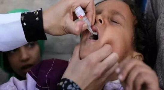 Fuenfter Poliofall in Pakistan gibt Anlass zur Sorge wegen Ueberwachungsluecken