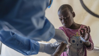 1100 MPOX Todesfaelle in ganz Afrika registriert CDC