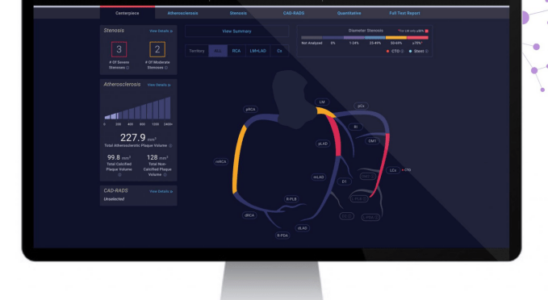 Cleerly sammelt 106 Millionen US Dollar von Insight Partners fuer die