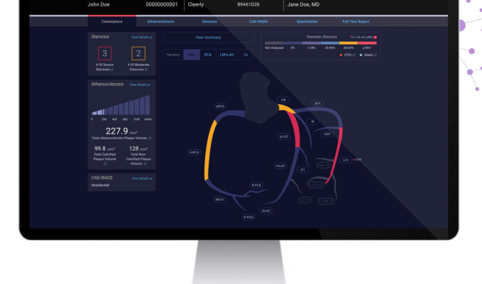 Cleerly sammelt 106 Millionen US Dollar von Insight Partners fuer die