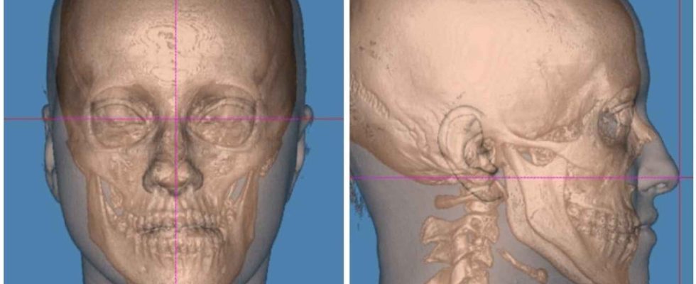 La nouvelle chirurgie espagnole qui corrige les anomalies de la