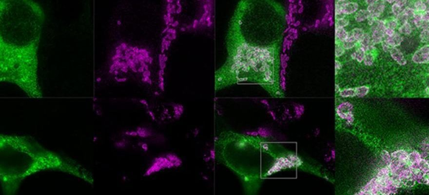 Un gene denisovien pourrait nous predisposer a la depression