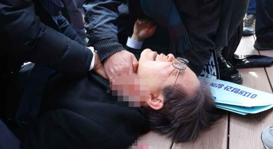 Un chef de lopposition poignarde au cou en Coree du