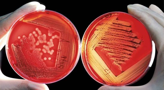 un nouvel antibiotique est efficace contre lun des agents pathogenes