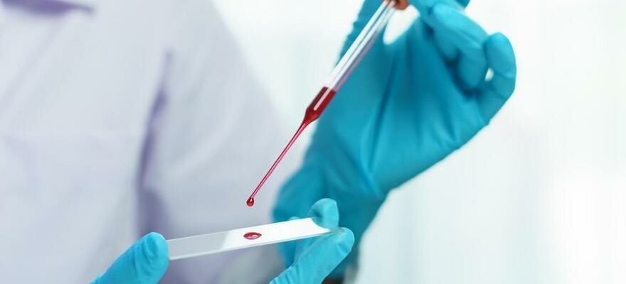 Un test sanguin peut predire de futures rechutes chez les