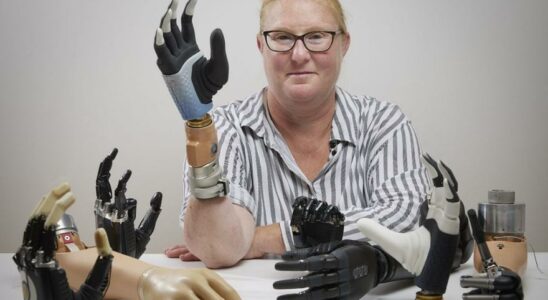 Une main bionique revolutionnaire fusionne directement avec le corps humain