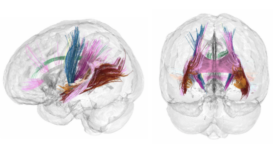 Ils decouvrent comment la grossesse modifie le cerveau de la