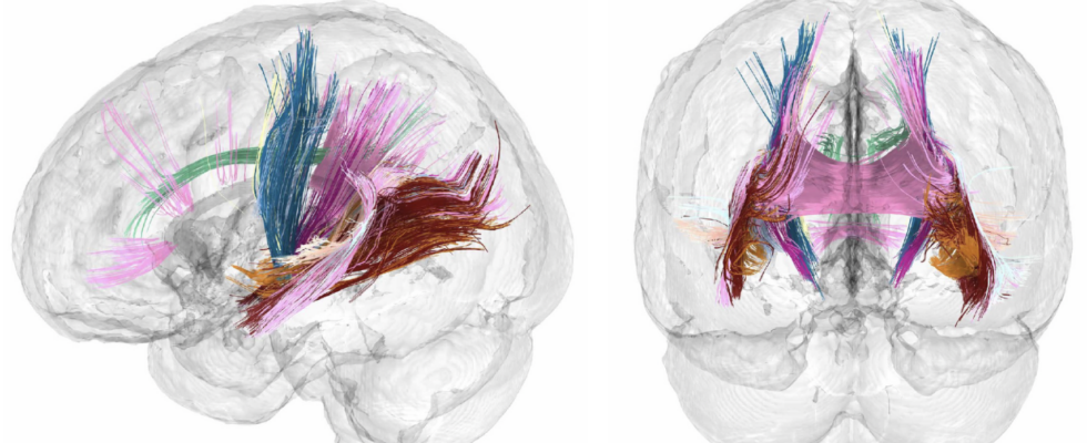 Ils decouvrent comment la grossesse modifie le cerveau de la