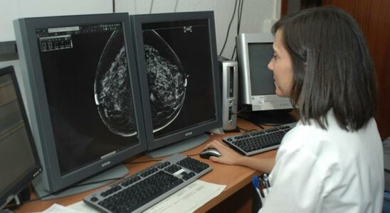 Limmunotherapie augmente les chances de guerison du cancer du sein