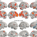 Cest ainsi que le cerveau sactive lorsque vous aimez vos