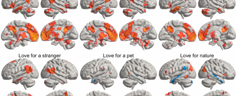 Cest ainsi que le cerveau sactive lorsque vous aimez vos