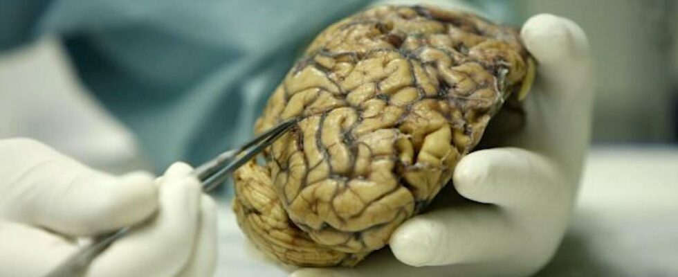 du premier medicament contre la schizophrenie en 75 ans a