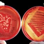 Pourquoi les bacteries miroirs presentent un risque sans precedent