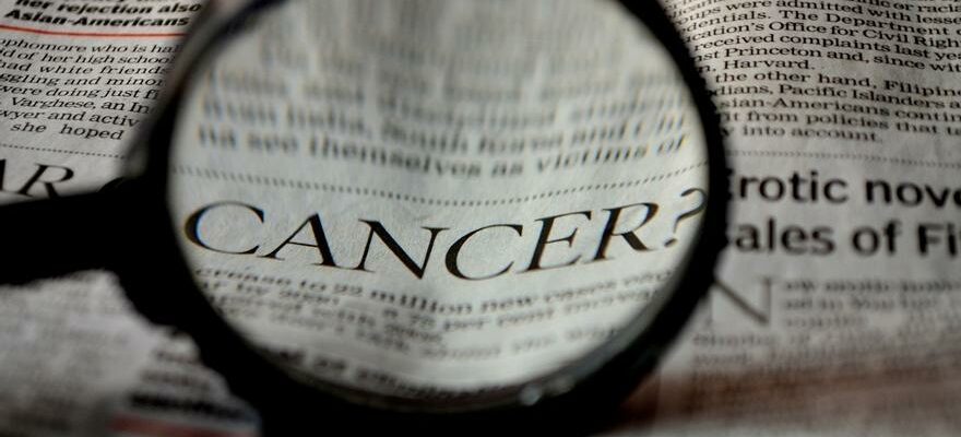 Quels sont les symptomes de cholangiocarcinome chaque jour est il plus