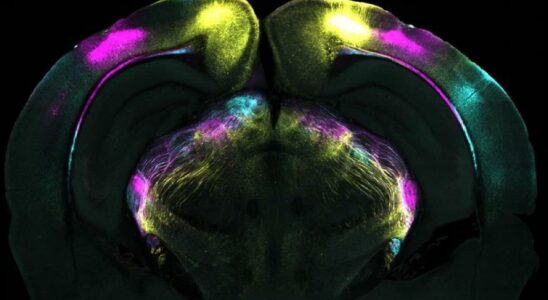 Ils decouvrent comment le cerveau surmonte la peur