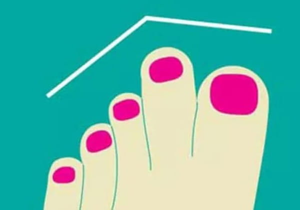 1690147527 326 The shape of your foot gives valuable clues to your