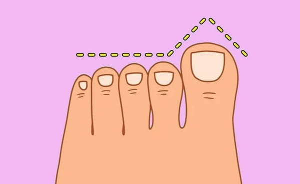 1690147527 775 The shape of your foot gives valuable clues to your