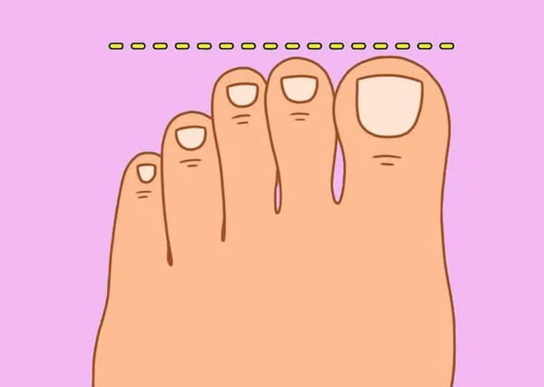 1690147527 843 The shape of your foot gives valuable clues to your
