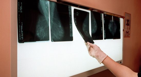 Breast cancer and colorectal cancer the screening rate is very