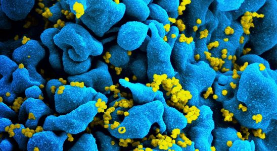 HIV a 6th patient in remission how his case disrupts