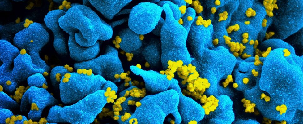 HIV a 6th patient in remission how his case disrupts