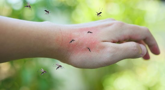 Itchy mosquito bite the immediate reflexes to know