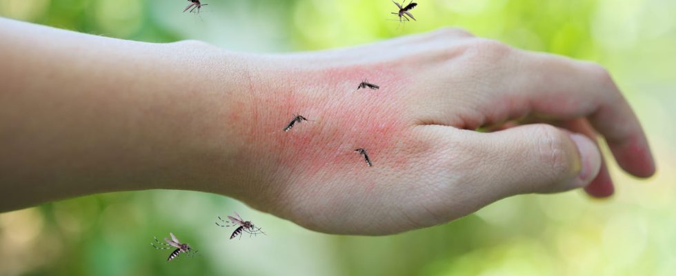 Itchy mosquito bite the immediate reflexes to know
