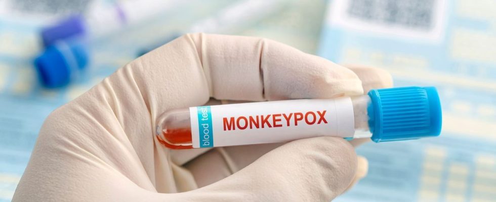 Monkey pox beware of the potential resurgence of cases at