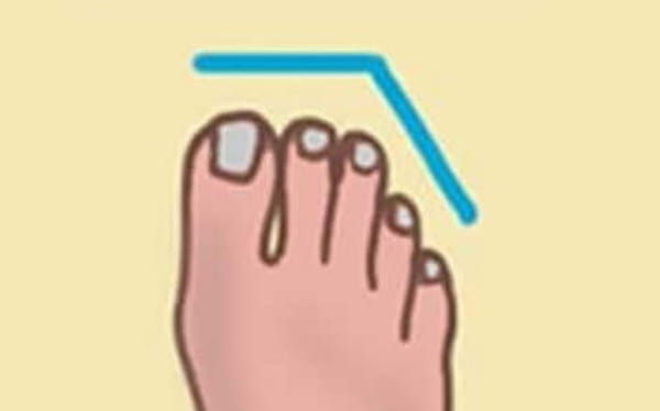 The shape of your foot gives valuable clues to your
