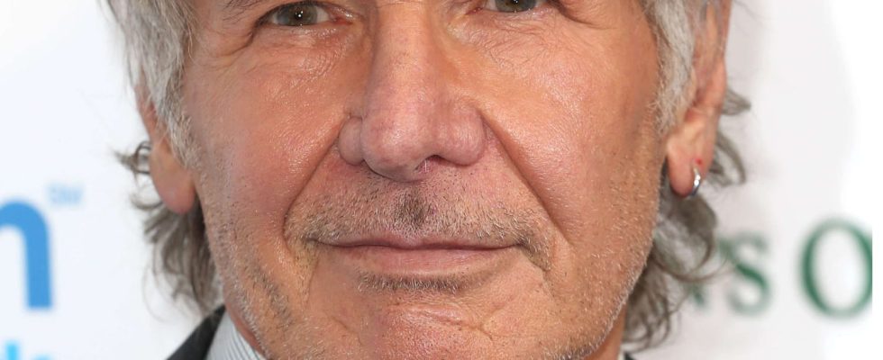 This accident scarred Harrison Fords face and you might not