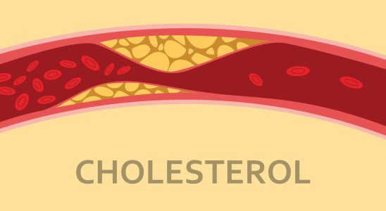 What is the difference between HDL and LDL cholesterol