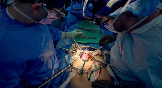 A pig kidney transplanted into a man continues to function