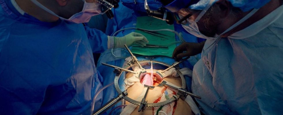A pig kidney transplanted into a man continues to function