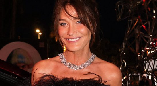 Carla Bruni twists her pedicure with this irresistible accessory and