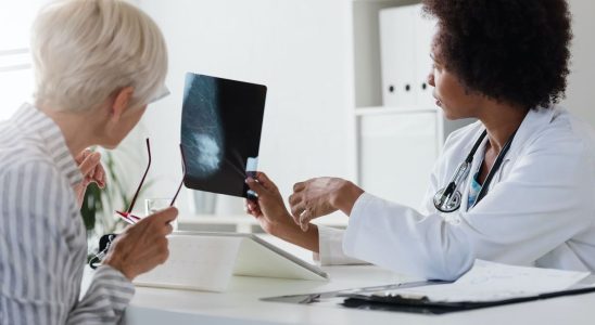 Overdiagnosis of breast cancer is screening still relevant after a