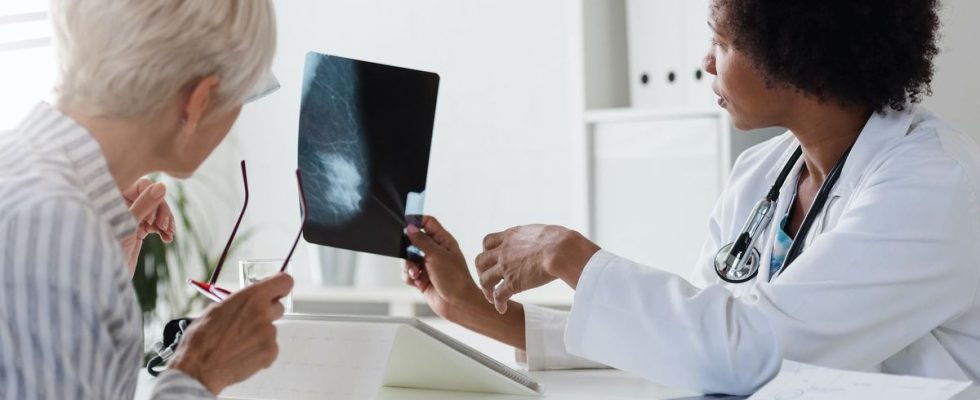 Overdiagnosis of breast cancer is screening still relevant after a