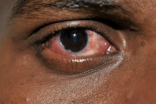 schools-were-closed-due-to-red-eye-epidemic-in-pakistan_5136_dhaphoto3