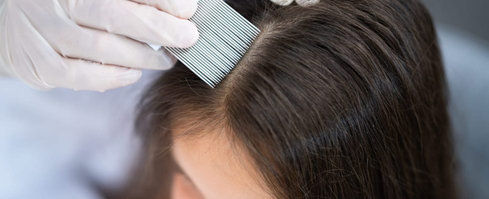 Lice are also making their comeback The right steps to