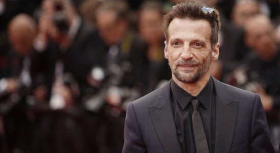 Matthieu Kassovitz gives his news after his accident Dr Gerald