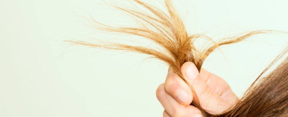 Rapunzel syndrome this habit with your hair may be pathological
