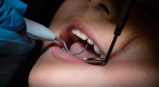 The government wants to save on dental care for young
